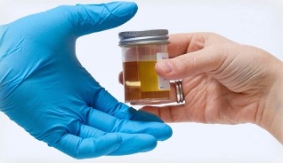 Of the disease and its diagnosis